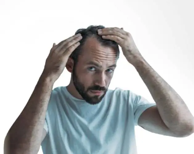 Hair Transplant Cost in Gurgaon