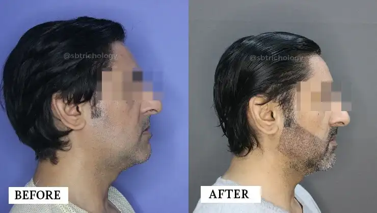 Patient Results