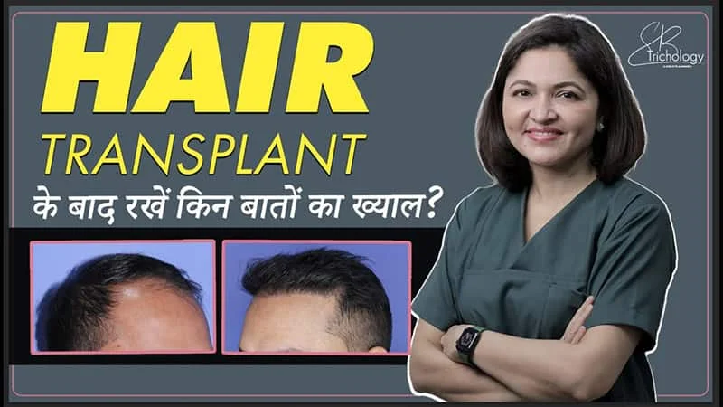 What is Hair-ART? Hair Transplant